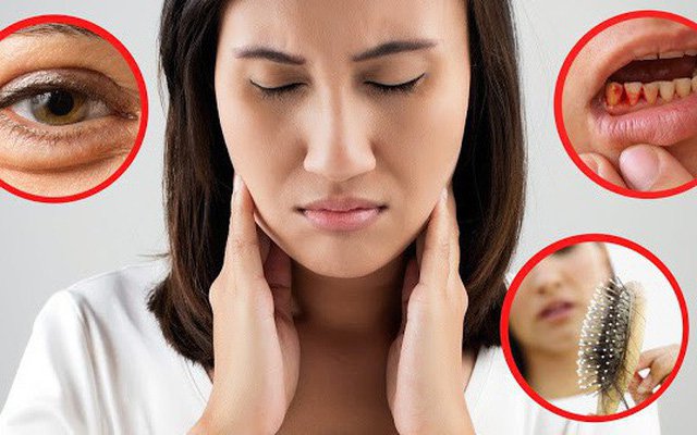 Tóc mỏng, da có vảy khô, móng dễ gãy: Cảnh giác thiếu Vitamin B7 (biotin) Tóc mỏng, da có vảy khô, móng dễ gãy: Cảnh giác thiếu Vitamin B7 (biotin)